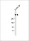 Ki-67 antibody