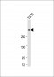 Ki-67 antibody