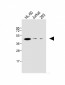 EDG6 Antibody (N-term)