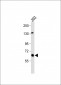 GLS Antibody (C-term)