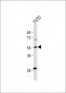 CYP27B1 Antibody (C-term)