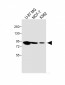 PLOD1 Antibody (N-term)