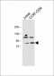 PLK2 (SNK) Antibody (C-term)