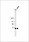 ESRP1 Antibody (N-term)