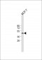 IDH1 Antibody (Center)