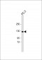 TRPM8 Antibody (C-term C940)