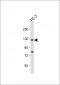 TRPM8 Antibody (C-term C940)