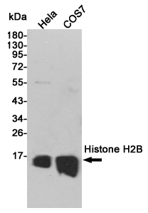 Histone H2B (7E2) Mouse mAb