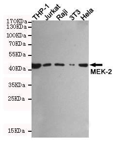 Rabbit IgG (5B2) Mouse mAb