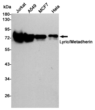 LYRIC/AEG1 (2E4) Mouse mAb