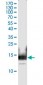 CTLA4 monoclonal antibody (M11), clone 5C12