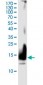 CTLA4 monoclonal antibody (M27), clone 7H8