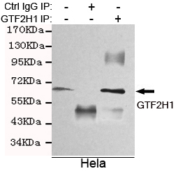 GTF2H1 (3E8) Mouse mAb