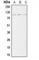 Anti-ACTN2 Antibody