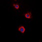 Anti-Adenylate Cyclase 5/6 Antibody