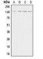 Anti-Adenylate Cyclase 5/6 Antibody