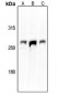 Anti-Aggrecan Antibody