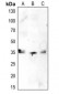 Anti-CDK1/2/3 (pT14) Antibody