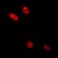 Anti-C/EBP delta/epsilon Antibody