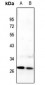 Anti-C/EBP delta/epsilon Antibody