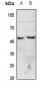 Anti-CHRNA7 Antibody