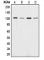 Anti-Catenin alpha 1/2 Antibody