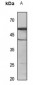 Anti-Cytochrome P450 2C9 Antibody