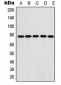 Anti-Fibulin 1 Antibody