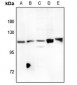 Anti-FOXM1 Antibody