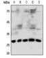 Anti-Connexin 32 Antibody