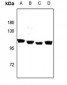 Anti-GPIPLD Antibody