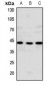 Anti-GPR20 Antibody