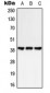 Anti-GPR25 Antibody