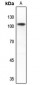 Anti-mGLUR2 Antibody