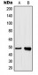 Anti-hnRNP H Antibody