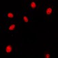 Anti-HOXA11/D11 Antibody