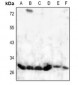 Anti-HOXD8 Antibody