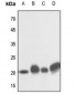 Anti-NRAS/HRAS/KRAS Antibody