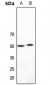 Anti-5-HT2A Antibody