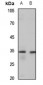 Anti-MAGEA3/6 Antibody