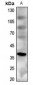 Anti-MC4 Receptor Antibody