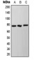 Anti-NDUFS1 Antibody