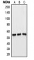 Anti-PFKFB1/4 Antibody