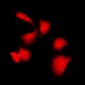 Anti-PKA C alpha/beta Antibody