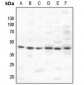 Anti-PKA C alpha/beta Antibody