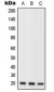 Anti-RPL11 Antibody