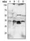 Anti-SNAI1/2 Antibody