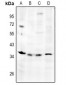 Anti-TSG6 Antibody