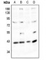 Anti-Podocin Antibody