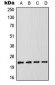 Anti-RAIDD Antibody